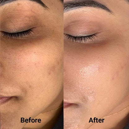 REGENSYS : PDRN Molecular Orbs